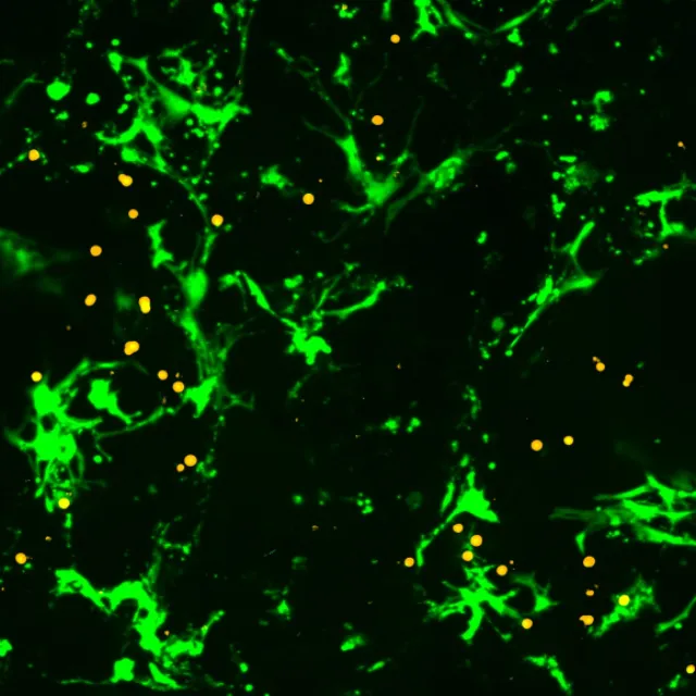 CompagOs on Supertrends: Bioprinted Bone Models