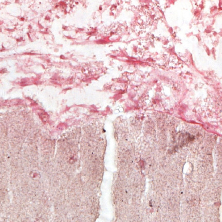 Histology staining of bone tissue